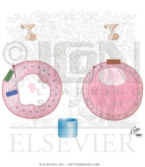 Watermarked preview of unlabeled image: Therapeutic Blockade of Thyroxine Formation and Release