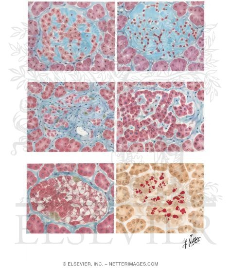 Watermarked preview of unlabeled image: Type 1 Diabetes Mellitus