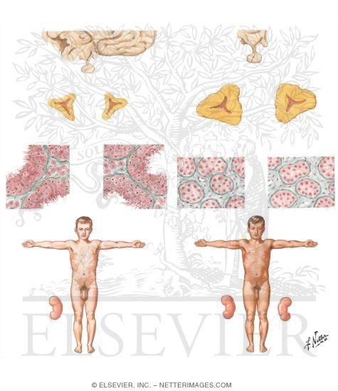 Watermarked preview of unlabeled image: Sexual Precocity in the Male