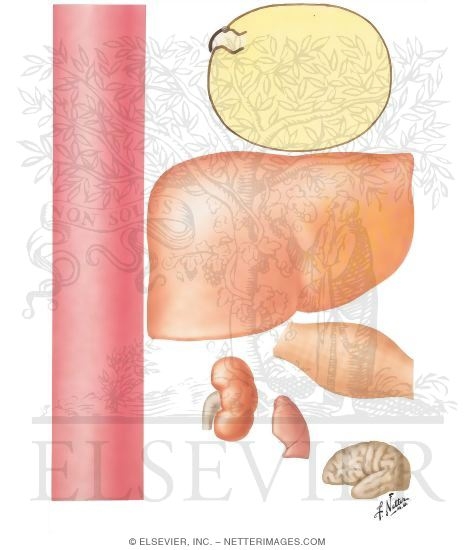 Diabetic Ketoacidosis