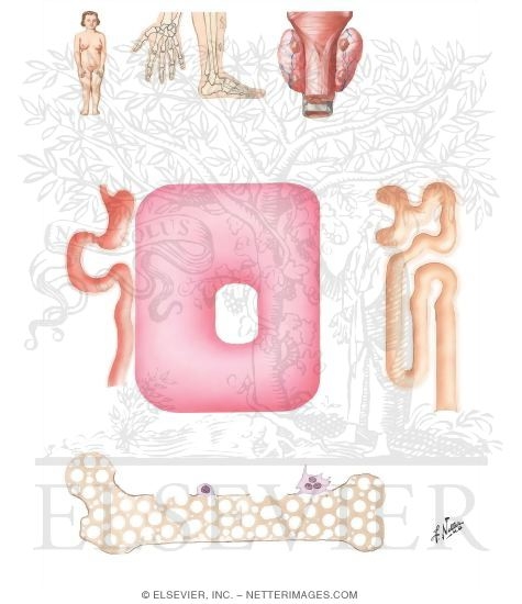 Watermarked preview of unlabeled image: Pathologic Physiology of Pseudohypoparathyroidsim