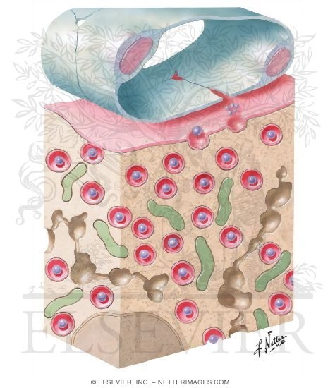 Watermarked preview of unlabeled image: Electron Microscopy of the Beta Cell