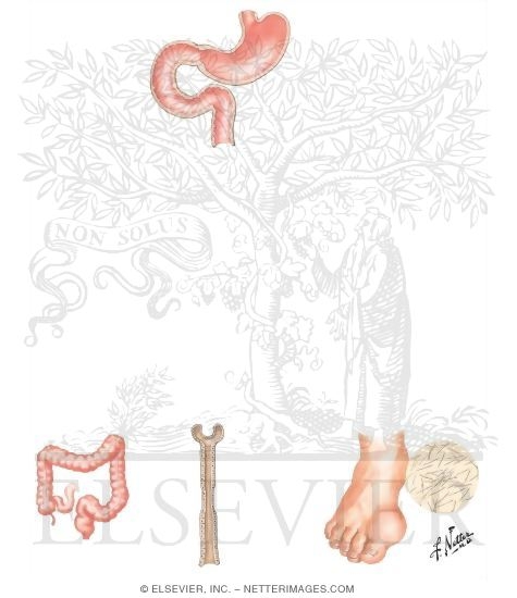 Watermarked preview of unlabeled image: Uric Acid Metabolism, Gout