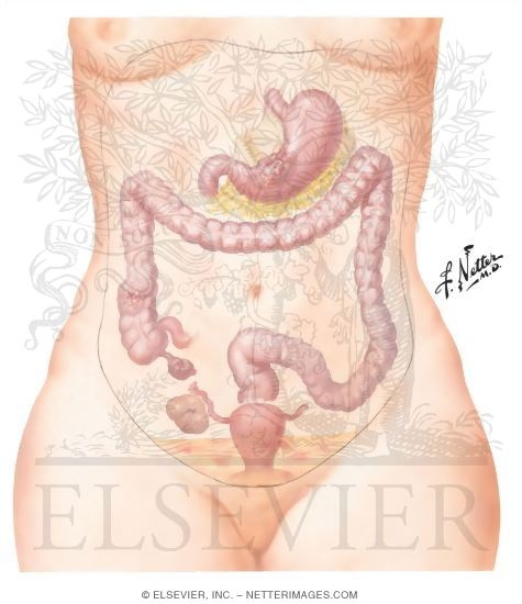 Watermarked preview of unlabeled image: Cancer of the Peritoneum