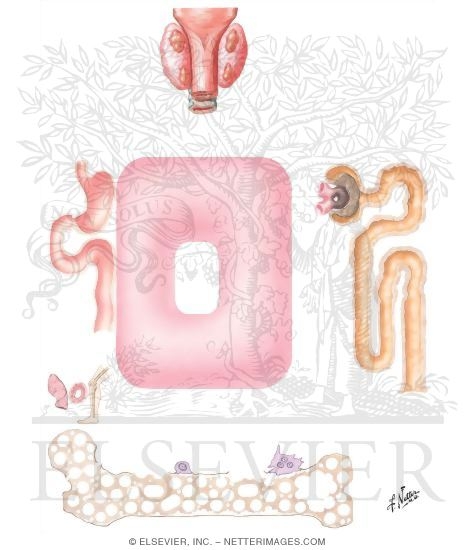 Renal Osteodystrophy