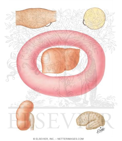Watermarked preview of unlabeled image: Consequences of Insulin Deprivation