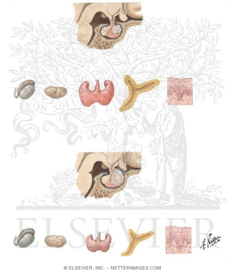 Selective and Partial Hypopituitarism
