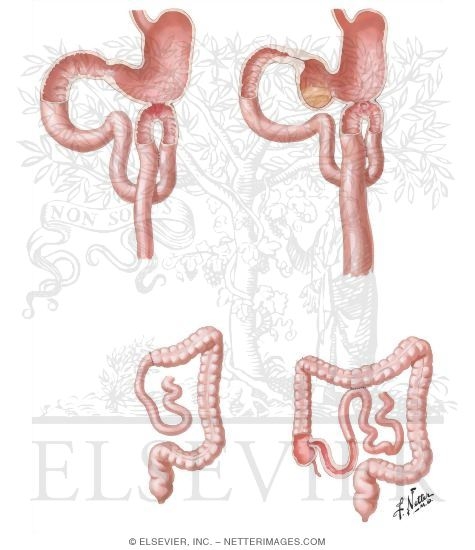 Watermarked preview of unlabeled image: Physiology of Gastro-Enteric Stomas