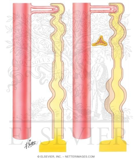 Watermarked preview of unlabeled image: Diuretics - Thiazides; Potassium - Retaining Diuretics
