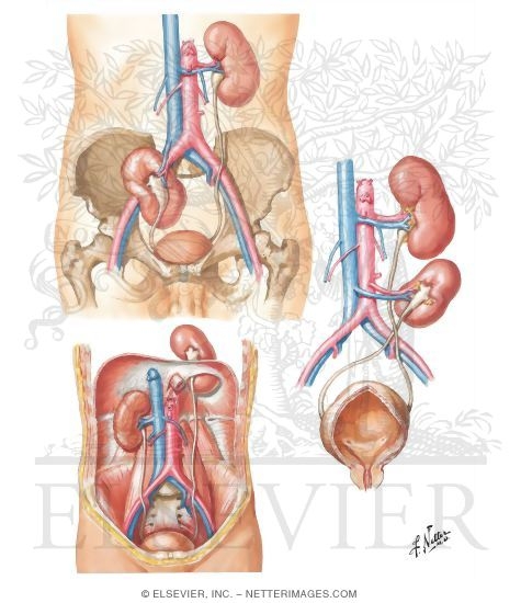 Ectopia of the Kidney