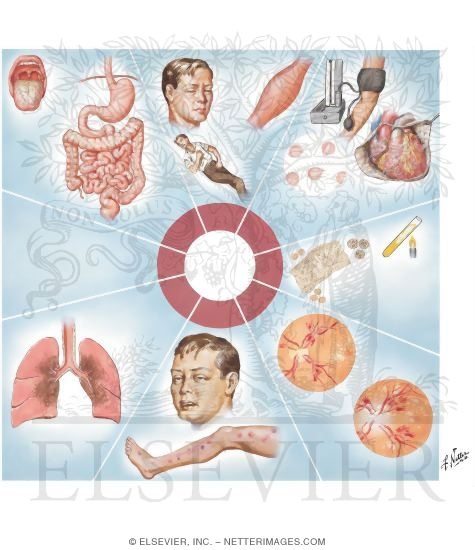 Uremia 