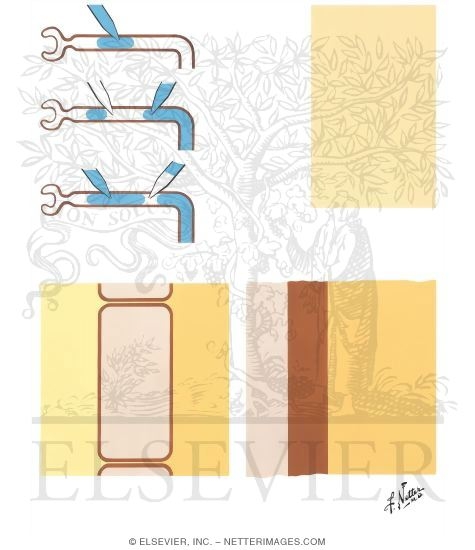Watermarked preview of unlabeled image: Sodium, Chloride, and Potassium Transport
