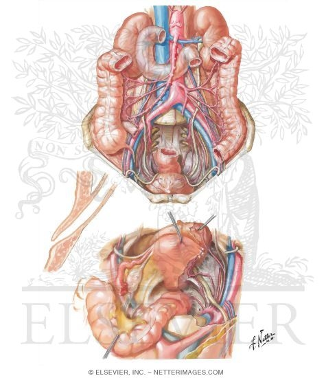 Anatomic Relations of Ureters
Ureters