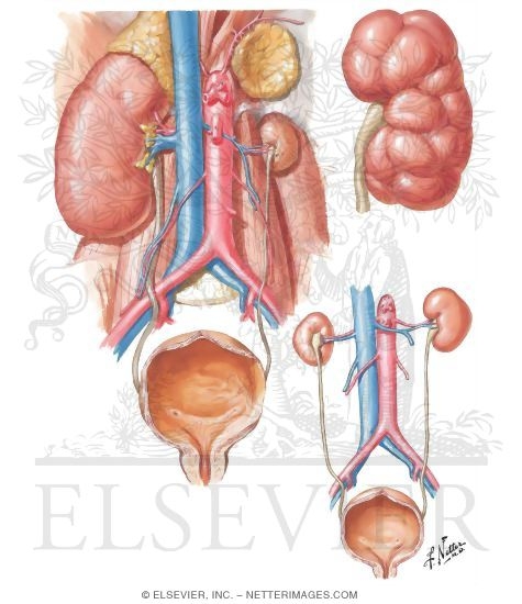 Watermarked preview of unlabeled image: Renal Hypoplasia