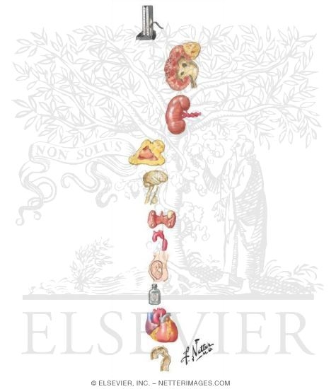 Watermarked preview of unlabeled image: Causes of Hypertension
