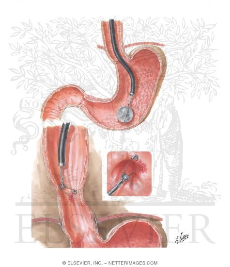 Watermarked preview of unlabeled image: Foreign Bodies