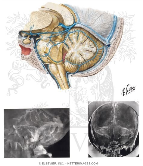 Veins of Posterior Cranial Fossa