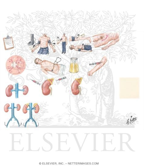 Watermarked preview of unlabeled image: Diagnostic Evaluation of Patients with Hypertension