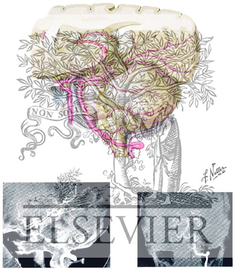 Watermarked preview of unlabeled image: Arteries of Posterior Cranial Fossa