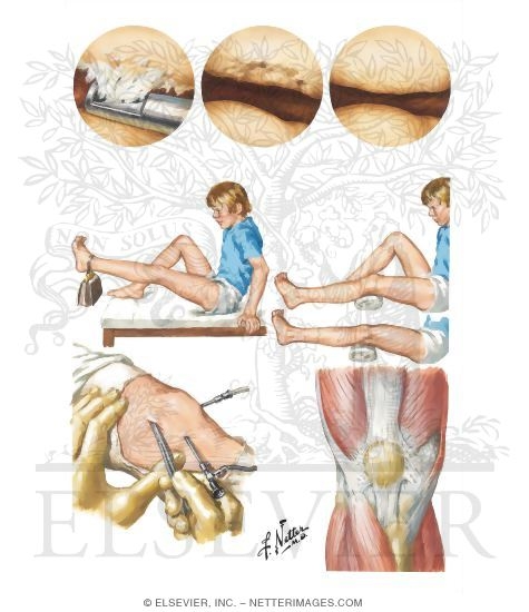Watermarked preview of unlabeled image: Disorders of Patella