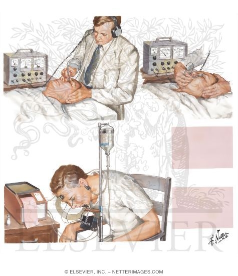 Watermarked preview of unlabeled image: Noninvasive Tests for Carotid Artery Blood Flow