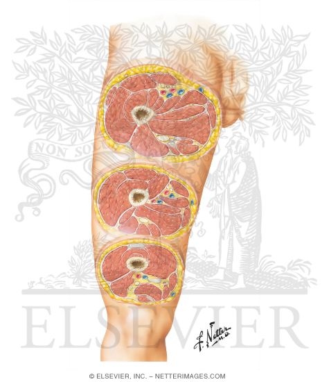 Cross-Sectional Anatomy of Thigh
Thigh: Serial Cross Sections