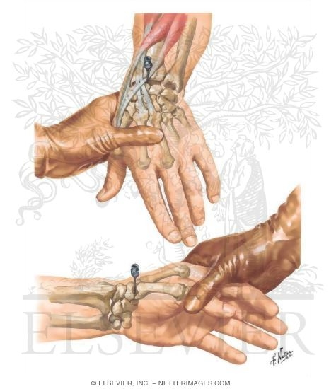 Watermarked preview of unlabeled image: The Wrist