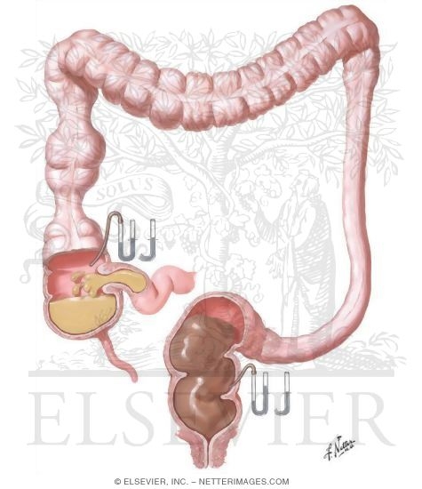 Watermarked preview of unlabeled image: Motility of Large Intestine
Colonic Motility