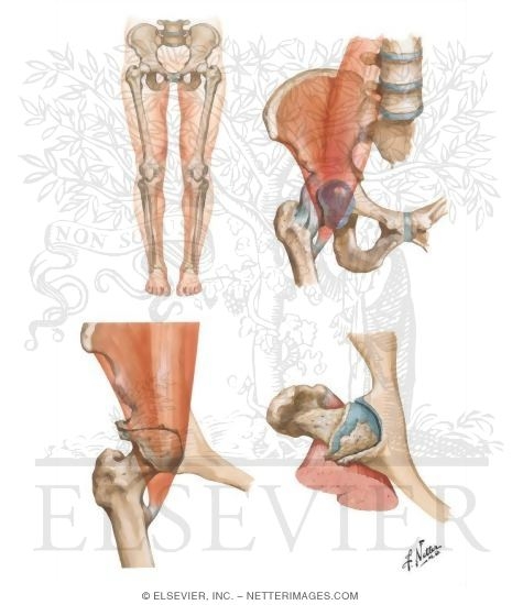 Watermarked preview of unlabeled image: Transient Synovitis; Osteoarthritis
