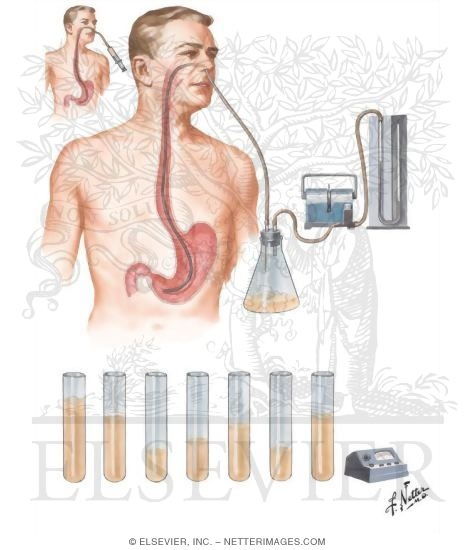 Watermarked preview of unlabeled image: Gastric Analysis