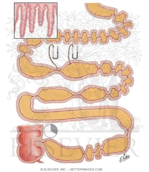 Watermarked preview of unlabeled image: Motility of Small Intestine