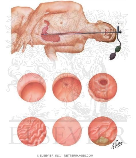 Watermarked preview of unlabeled image: Gastroscopy