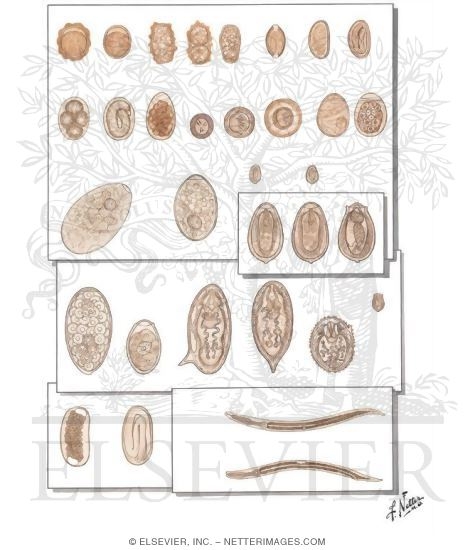 helminthiases protozoa)