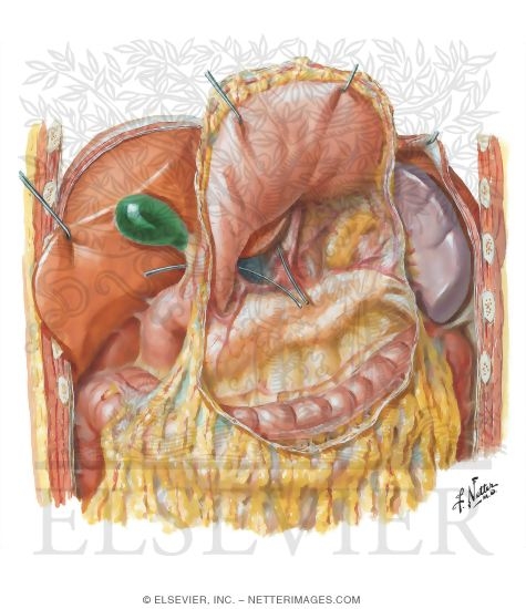 Omental Bursa: Stomach Reflected
Peritoneum