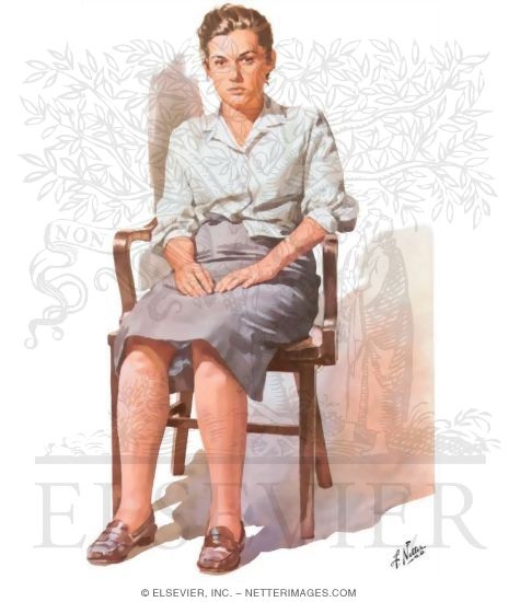 Watermarked preview of unlabeled image: Schizophrenic Disorder