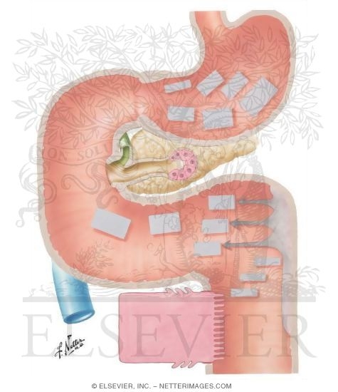 Digestion of Carbohydrates
Secretory, Digestive and Absorptive Functions of Small and Large Intestine - Secretion
Secretory, Digestive and Absorptive Functions