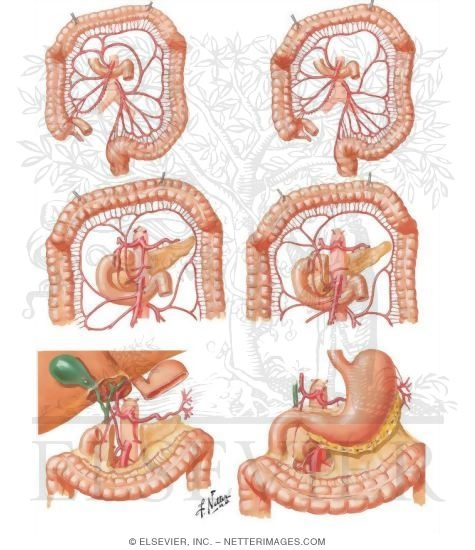 Watermarked preview of unlabeled image: Variations In Colic Arteries 
Blood Supply of Small and Large Intestine