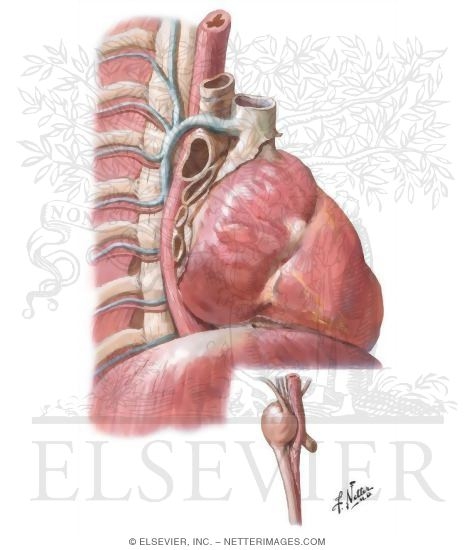 Watermarked preview of unlabeled image: Displacement of Esophagus