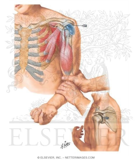 Watermarked preview of unlabeled image: The Shoulder