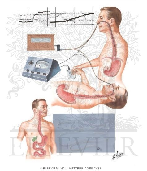 Watermarked preview of unlabeled image: Diagnostic Aids in Esophageal and Gastric Disorders