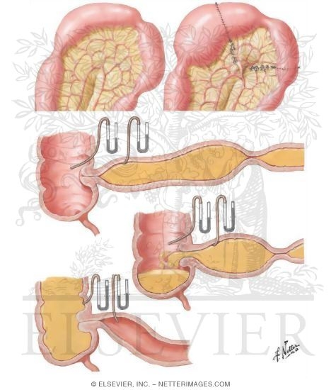 Watermarked preview of unlabeled image: Motility of Small Intestine