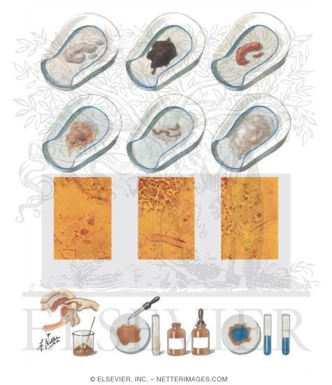 Watermarked preview of unlabeled image: Stool Examination