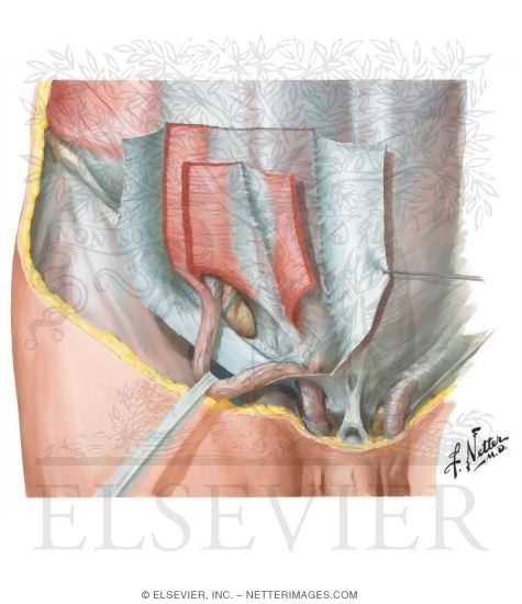Inguinal Canal
Inguinal Region: Dissection