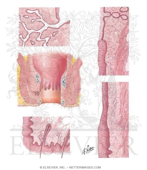 Rectum and Anal Canal