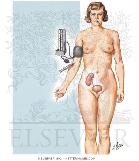 Watermarked preview of unlabeled image: Kidney Transplantation