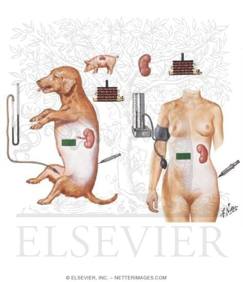 Watermarked preview of unlabeled image: Renovascular Hypertension