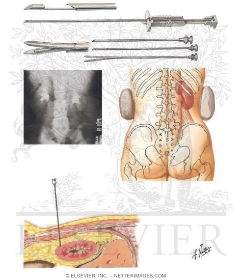 Watermarked preview of unlabeled image: Renal Biopsy
