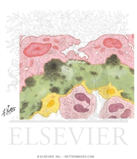 Watermarked preview of unlabeled image: Kidney Transplantation