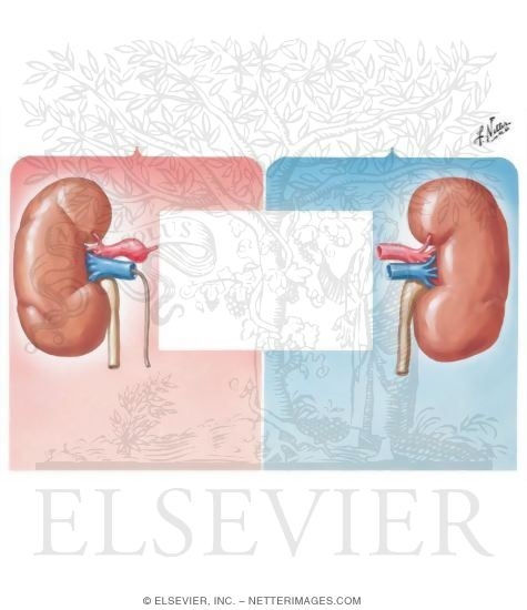 Watermarked preview of unlabeled image: Renovascular Hypertension