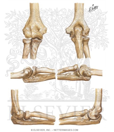 Bones of Elbow